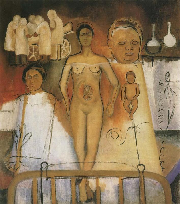 Frida Kahlo Kahlo and Caesarean operation